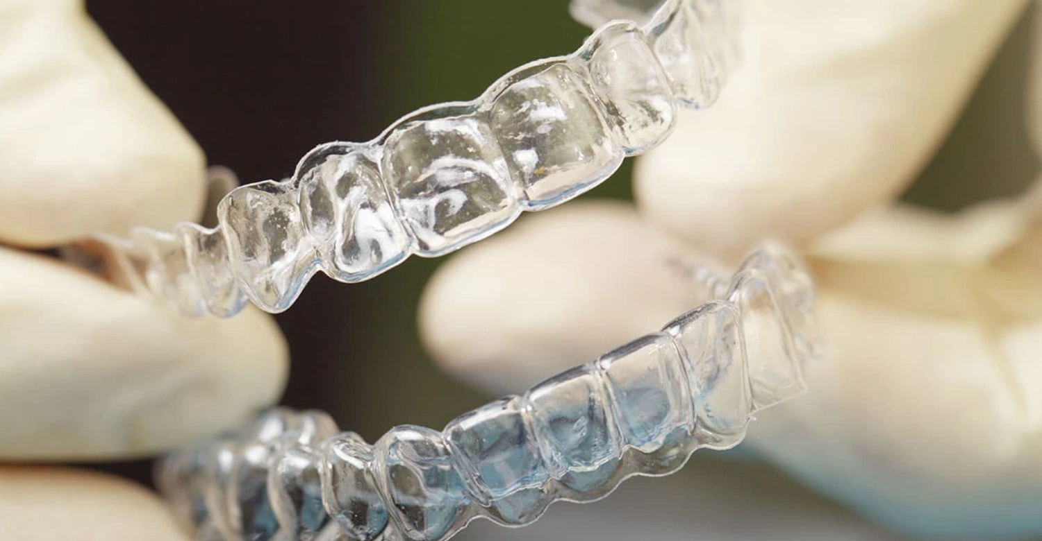 Clear Aligners Vitrin Clinic's Guide to Modern Teeth Straightening Inblog